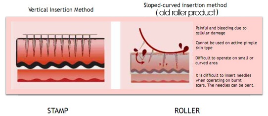 skin needling